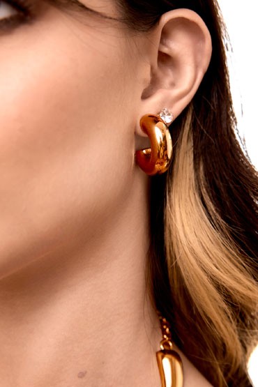 Aretes